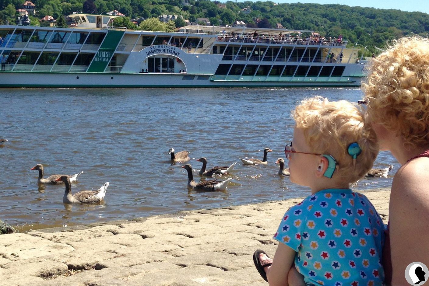 CI Kopf 2018 männlich Kind